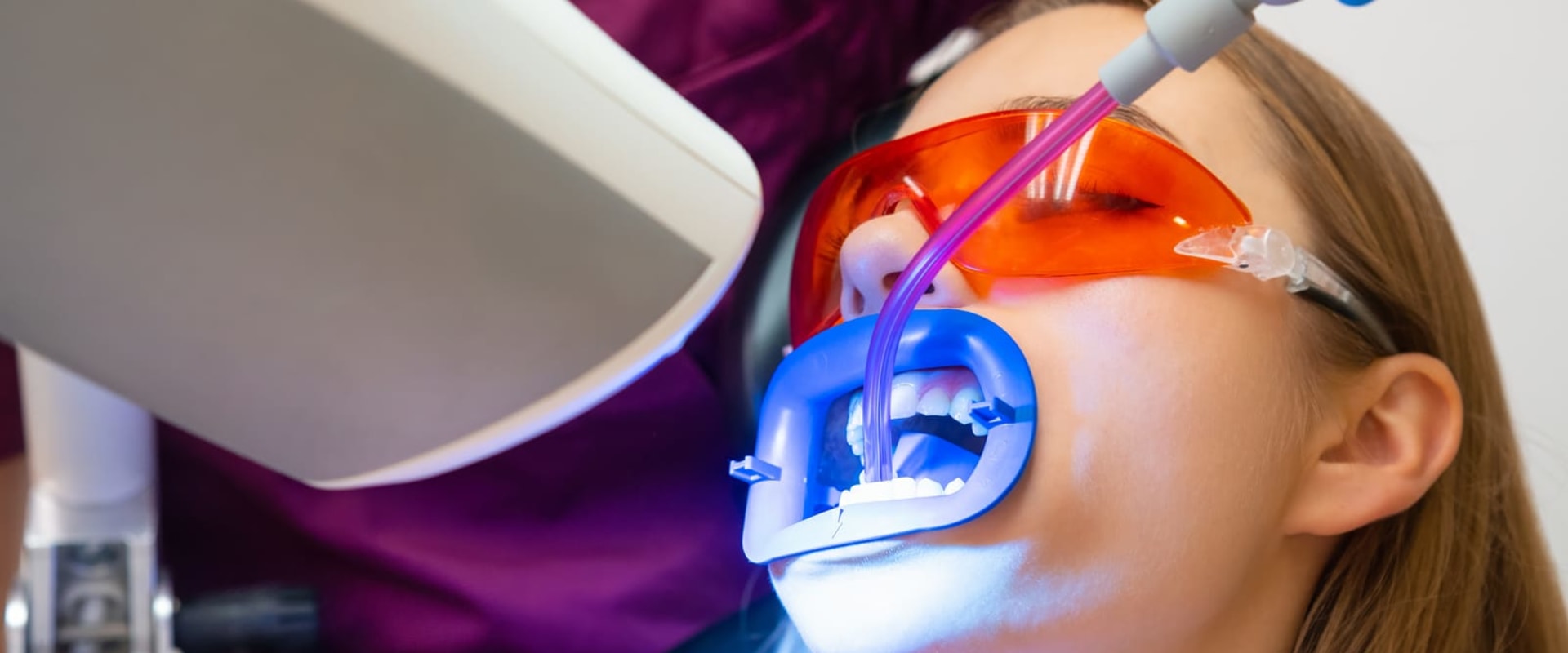 Brighter Smiles Await: The Ultimate Guide To Teeth Whitening In ...