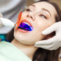 San Antonio Secrets: The Vital Role Of Endodontists In Teeth Whitening