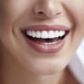 Brighten Up Your Smile With Teeth Whitening In London: Expert Tips From An Oral Health Specialist