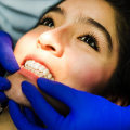 Say Goodbye To Stains: Teeth Whitening Options At Cedar Park Dental Office