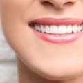 Illuminate Your Confidence: The Beauty Of Teeth Whitening In Austin