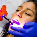Revitalize Your Smile With Professional Teeth Whitening In Helotes, TX