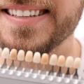 How Often is Too Often for Teeth Whitening? A Professional's Guide