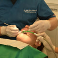 Brighten Your Smile with Professional Teeth Whitening