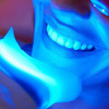 Transform Your Smile: Teeth Whitening In San Antonio