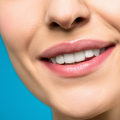 Unlock Your Radiant Smile: Finding The Perfect Dental Cosmetic Clinic For Teeth Whitening In Sydney