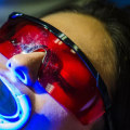 Bright And Beautiful: Choosing Teeth Whitening In Edmonds