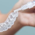 The Benefits of Professional Teeth Whitening vs Over-the-Counter Products