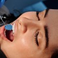 Reveal Your Inner Glow: Teeth Whitening In Spring Branch, Texas