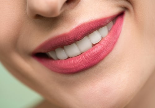 Choosing the Right Teeth Whitening Dentist in London: What You Need to Know