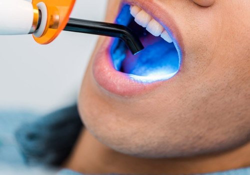 What Are the Best Alternatives to Professional Teeth Whitening Treatments?