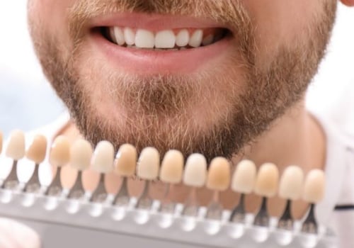 What is the Ideal Age for Teeth Whitening Treatments?