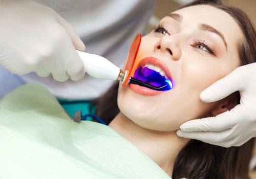 San Antonio Secrets: The Vital Role Of Endodontists In Teeth Whitening