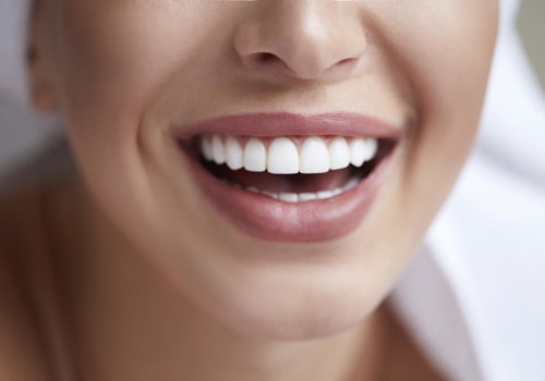 Brighten Up Your Smile With Teeth Whitening In London: Expert Tips From An Oral Health Specialist