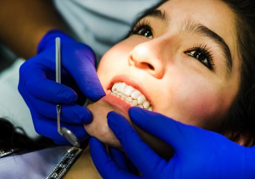 Say Goodbye To Stains: Teeth Whitening Options At Cedar Park Dental Office