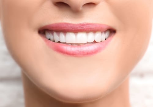 Illuminate Your Confidence: The Beauty Of Teeth Whitening In Austin