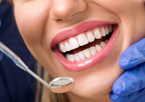How To Find The Right Dental Care Facility For Premium Teeth Whitening In Basel