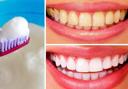 Natural Ways to Whiten Your Teeth