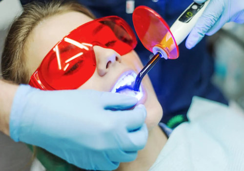 Revitalize Your Smile: Discover The Power Of Teeth Whitening In Austin