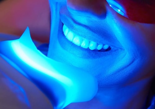 Transform Your Smile: Teeth Whitening In San Antonio
