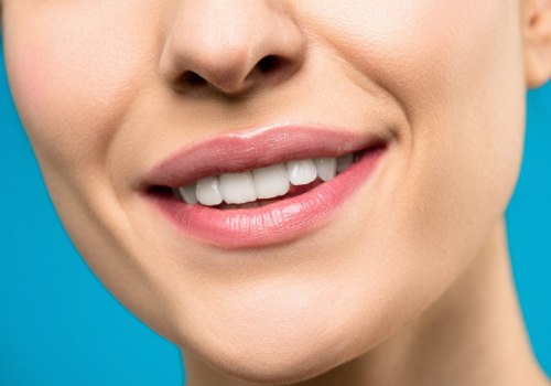 Unlock Your Radiant Smile: Finding The Perfect Dental Cosmetic Clinic For Teeth Whitening In Sydney