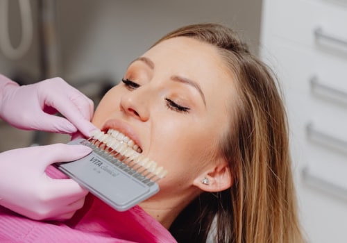 Unveil Your Radiant Smile: The Power Of Teeth Whitening Before Porcelain Veneers In Austin