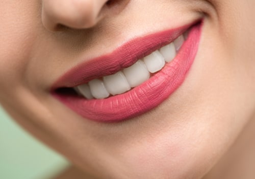 The Significance Of Dentists Open On Saturdays In Sterling, Virginia, For Teeth Whitening