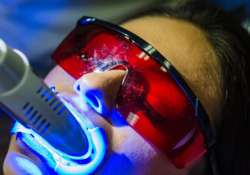Bright And Beautiful: Choosing Teeth Whitening In Edmonds