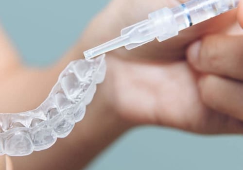 The Benefits of Professional Teeth Whitening vs Over-the-Counter Products