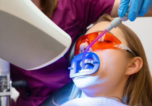 Bright Smiles In Claycomo: Your Ultimate Guide To Teeth Whitening