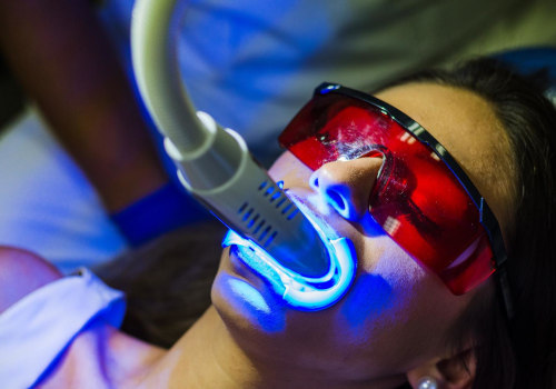 Dentist Whitening In Helotes, TX: Your Path To A Hollywood Smile
